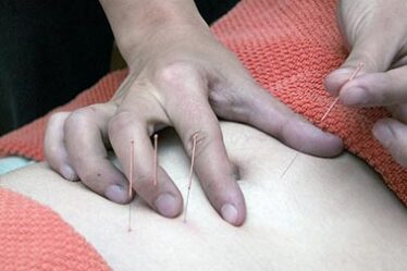 L'acupuncture, un allié pour la santé